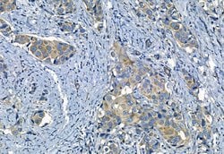 Invitrogen MMP2 Polyclonal Antibody 100 &mu;L; Unconjugated:Antibodies,