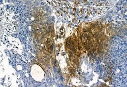 Invitrogen MMP2 Polyclonal Antibody 100 &mu;L; Unconjugated:Antibodies,