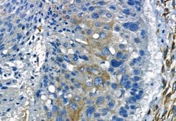 Invitrogen MMP2 Polyclonal Antibody 100 &mu;L; Unconjugated:Antibodies,