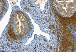 Invitrogen MMP2 Polyclonal Antibody 100 &mu;L; Unconjugated:Antibodies,
