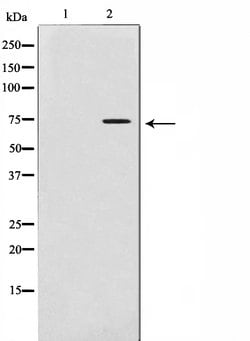 Invitrogen MMP2 Polyclonal Antibody 100 &mu;L; Unconjugated:Antibodies,