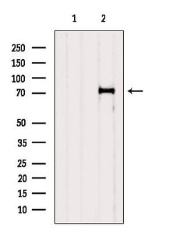 Invitrogen MMP2 Polyclonal Antibody 100 &mu;L; Unconjugated:Antibodies,
