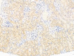 Invitrogen MOV10 Polyclonal Antibody 100 &mu;L; Unconjugated:Antikroppar
