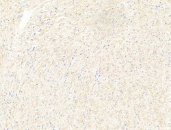 Invitrogen MOV10 Polyclonal Antibody 100 &mu;L; Unconjugated:Antikroppar