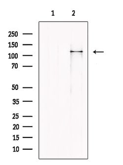 Invitrogen MOV10 Polyclonal Antibody 100 &mu;L; Unconjugated:Antikroppar