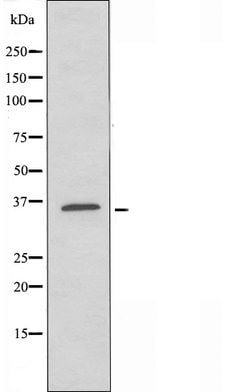Invitrogen CD200R Polyclonal Antibody 100 &mu;L; Unconjugated:Antibodies,