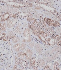 Invitrogen CD9 Polyclonal Antibody 200 &mu;L; Unconjugated:Antibodies,