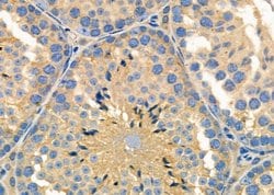 Invitrogen MRPS15 Polyclonal Antibody 100 &mu;L; Unconjugated:Antibodies,