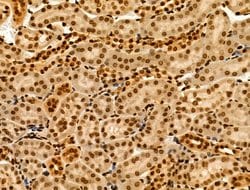 Invitrogen MTA1 Polyclonal Antibody 100 &mu;L; Unconjugated:Antibodies,