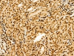 Invitrogen MTA1 Polyclonal Antibody 100 &mu;L; Unconjugated:Antibodies,