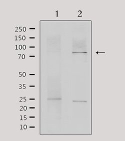 Invitrogen MTA1 Polyclonal Antibody 100 &mu;L; Unconjugated:Antibodies,