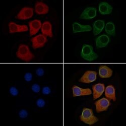 Invitrogen MUC5AC Polyclonal Antibody 100 &mu;L; Unconjugated:Antibodies,