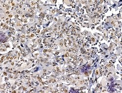 Invitrogen MUM1 Polyclonal Antibody 100 &mu;L; Unconjugated:Antikörper