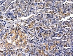 Invitrogen MUM1 Polyclonal Antibody 100 &mu;L; Unconjugated:Antikörper