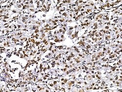 Invitrogen MUM1 Polyclonal Antibody 100 &mu;L; Unconjugated:Antikörper