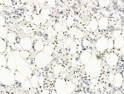 Invitrogen MUM1 Polyclonal Antibody 100 &mu;L; Unconjugated:Antikörper