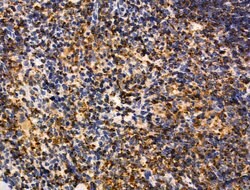 Invitrogen MUM1 Polyclonal Antibody 100 &mu;L; Unconjugated:Antikörper