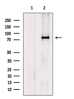 Invitrogen MUM1 Polyclonal Antibody 100 &mu;L; Unconjugated:Antikörper