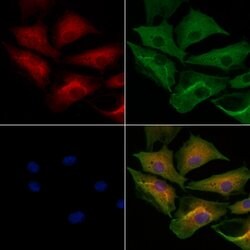 Invitrogen MYBPC3 Polyclonal Antibody 100 &mu;L; Unconjugated:Antibodies,