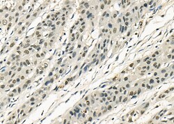 Invitrogen MYBPC3 Polyclonal Antibody 100 &mu;L; Unconjugated:Antibodies,