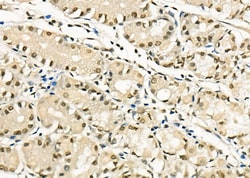 Invitrogen MYBPC3 Polyclonal Antibody 100 &mu;L; Unconjugated:Antibodies,