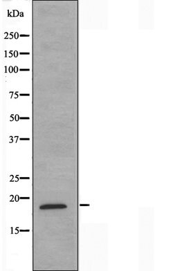 Invitrogen MECOM Polyclonal Antibody 100 &mu;L; Unconjugated:Antibodies,
