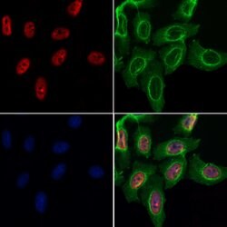 Invitrogen MYF5 Polyclonal Antibody 100 &mu;L; Unconjugated:Antibodies,