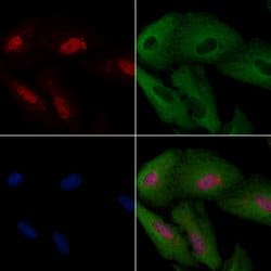 Invitrogen MYF5 Polyclonal Antibody 100 &mu;L; Unconjugated:Antibodies,