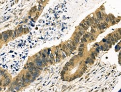 Invitrogen MYF5 Polyclonal Antibody 100 &mu;L; Unconjugated:Antibodies,