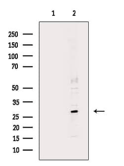 Invitrogen MYF5 Polyclonal Antibody 100 &mu;L; Unconjugated:Antibodies,