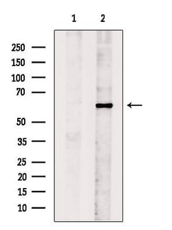 Invitrogen MYOD Polyclonal Antibody 100 &mu;L; Unconjugated:Antibodies,