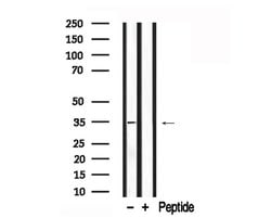 Invitrogen MYOD Polyclonal Antibody 100 &mu;L; Unconjugated:Antibodies,