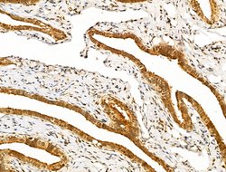 Invitrogen NANOS3 Polyclonal Antibody 100 &mu;L; Unconjugated:Antibodies,