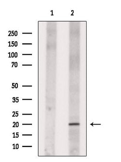 Invitrogen NANOS3 Polyclonal Antibody 100 &mu;L; Unconjugated:Antibodies,