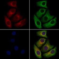 Invitrogen NAPE PLD Polyclonal Antibody 100 &mu;L; Unconjugated:Antibodies,