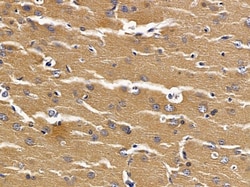 Invitrogen NAT14 Polyclonal Antibody 100 &mu;L; Unconjugated:Antibodies,