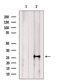 Invitrogen NAT14 Polyclonal Antibody 100 &mu;L; Unconjugated:Antibodies,