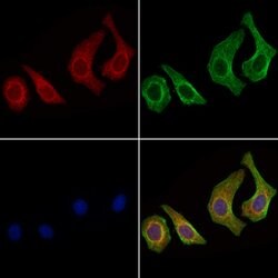 NPR3 Polyclonal Antibody:Antibodies, Polyclonal