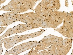 Invitrogen SCN5A Polyclonal Antibody 100 &mu;L; Unconjugated:Antibodies,