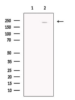 Invitrogen SCN5A Polyclonal Antibody 100 &mu;L; Unconjugated:Antibodies,