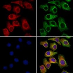 Invitrogen SCN10A Polyclonal Antibody 100 &mu;L | Buy Online | Invitrogen&trade; | Fisher Scientific