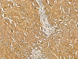 Invitrogen SCN10A Polyclonal Antibody 100 &mu;L | Buy Online | Invitrogen&trade; | Fisher Scientific
