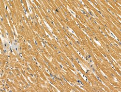 Invitrogen SCN10A Polyclonal Antibody 100 &mu;L | Buy Online | Invitrogen&trade; | Fisher Scientific