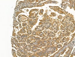 Invitrogen SCN10A Polyclonal Antibody 100 &mu;L | Buy Online | Invitrogen&trade; | Fisher Scientific