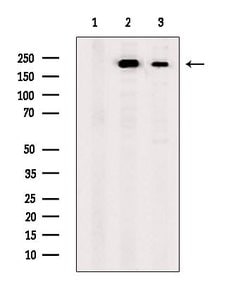 Invitrogen SCN10A Polyclonal Antibody 100 &mu;L | Buy Online | Invitrogen&trade; | Fisher Scientific