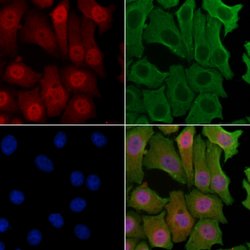 Invitrogen NCBP1 Polyclonal Antibody 100 &mu;L; Unconjugated:Antibodies,