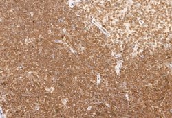 NCOA4 Polyclonal Antibody:Antibodies, Polyclonal