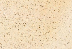 NCOA4 Polyclonal Antibody:Antibodies, Polyclonal