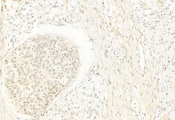 NCOA4 Polyclonal Antibody:Antibodies, Polyclonal