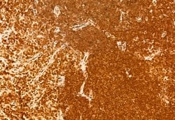 NCOA4 Polyclonal Antibody:Antibodies, Polyclonal